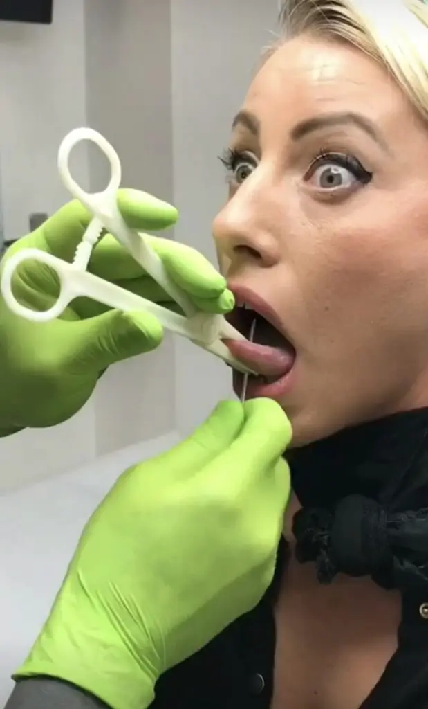 Tongue piercing procedure 