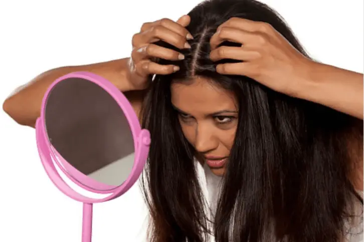 How to spot dry scalp vs dandruff in the hair