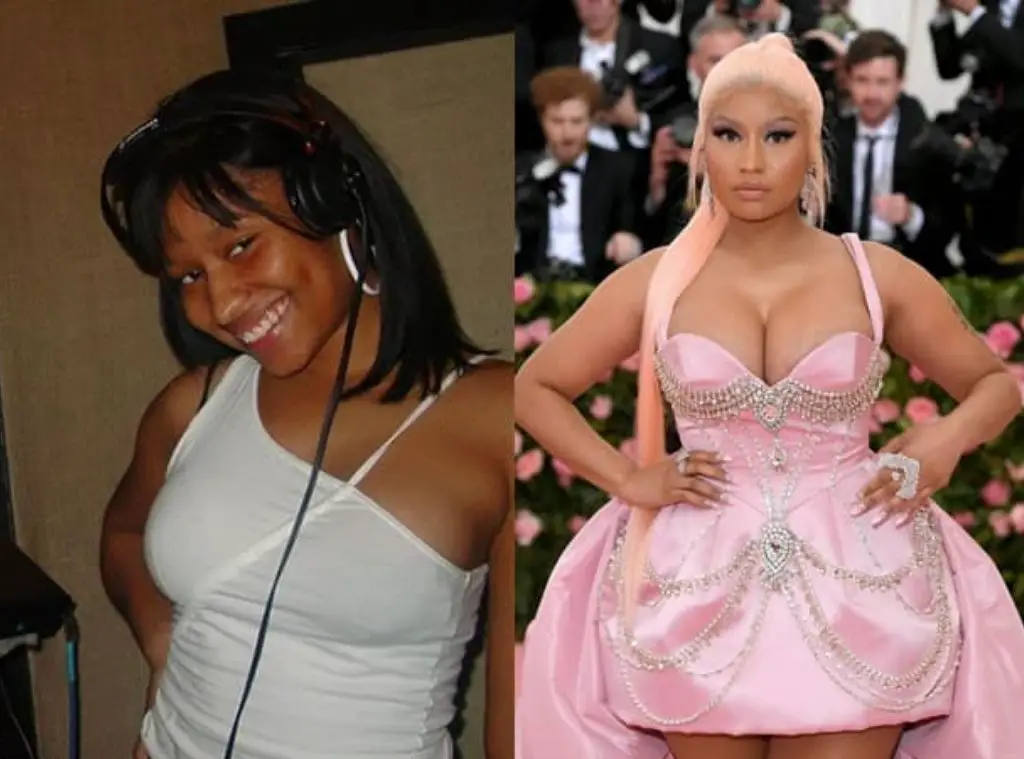Before and after photos of Nicki Minaj
