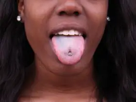 Infected Tongue piercing