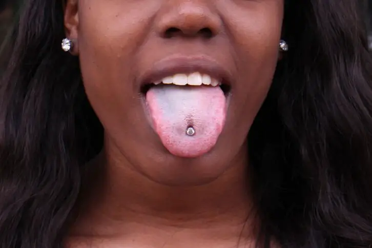 Infected Tongue piercing