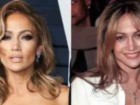 Jennifer Lopez Plastic Surgery JLo