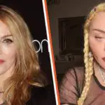 Madonna facelift