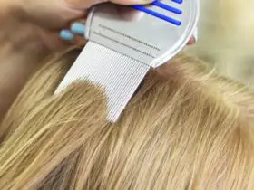 lice in blonde hair