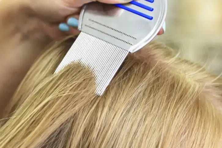head lice eggs on blonde hair
